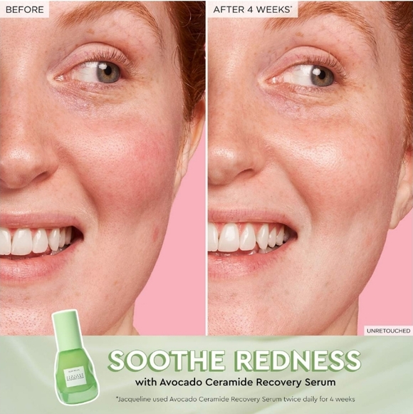 Glow Recipe Avocado Ceramide Recovery Serum, 30ml, NIB - Picture 3 of 7